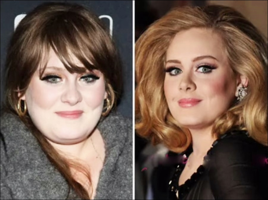 Adele sieht gut aus nach plastischer Chirurgie  