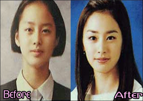 Kim Tae Hee Plastische Chirurgie vor und nach Gesicht Fotos  
