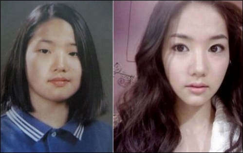 Park Min Young vor und nach Plastische Chirurgie Pics  