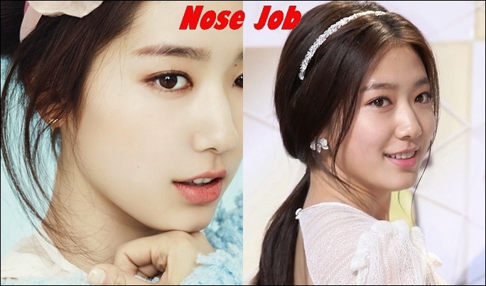 Park Shin Hye Plastische Chirurgie Nase Job vor und nach Fotos  