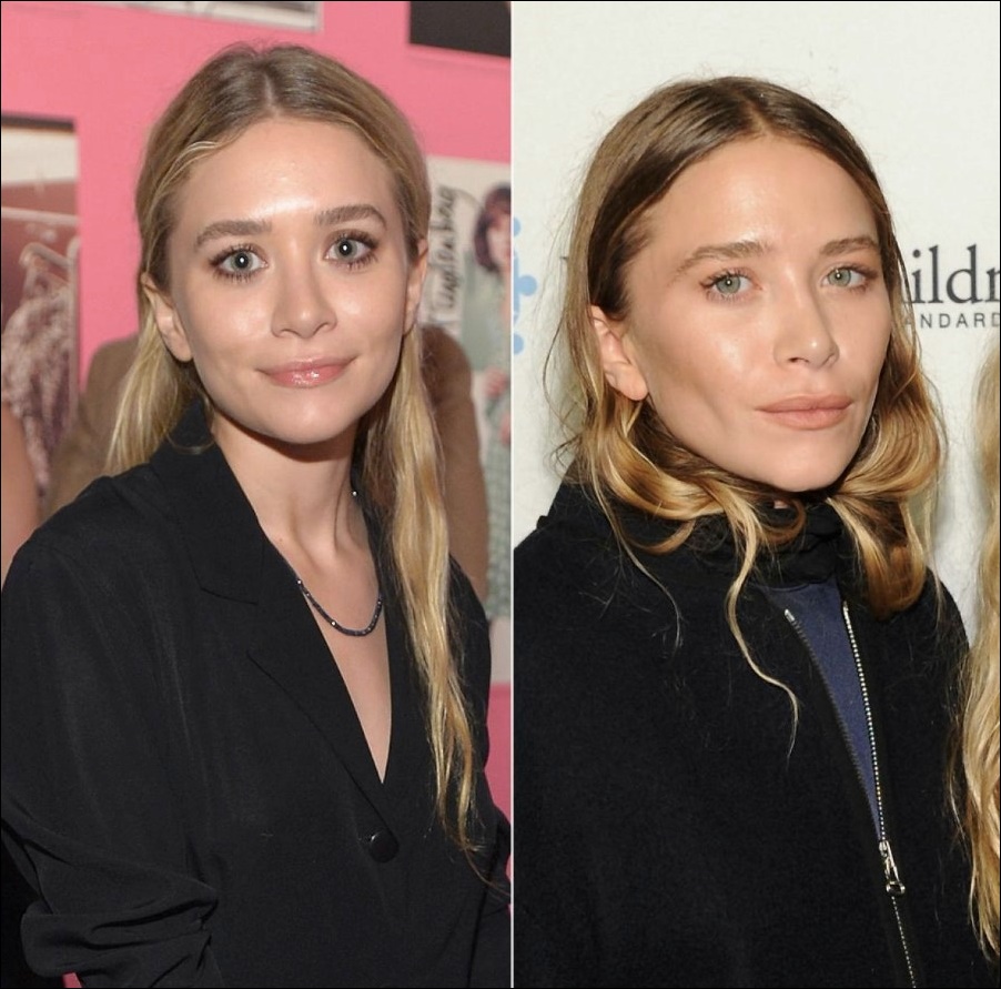 Mary-Kate Olsen plastische Chirurgie, um sich von Ashley zu unterscheiden  
