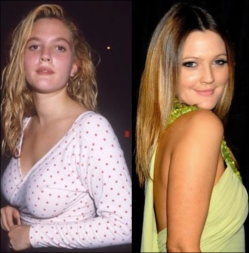 Drew Barrymore süße Mädchen benutzen auch plastische Chirurgie!  