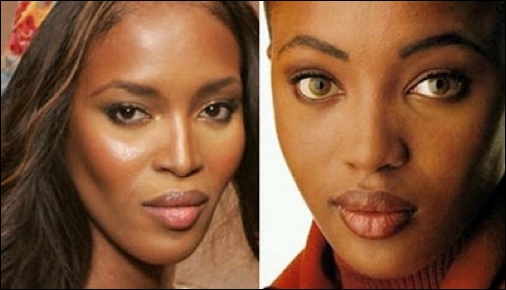 Afroamerikanische Nasenkorrektur vor und nach Bildern  
