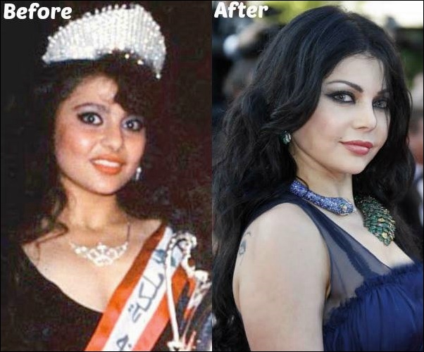 Haifa Wehbe Plastische Chirurgie Vorher-Nachher Fotos  
