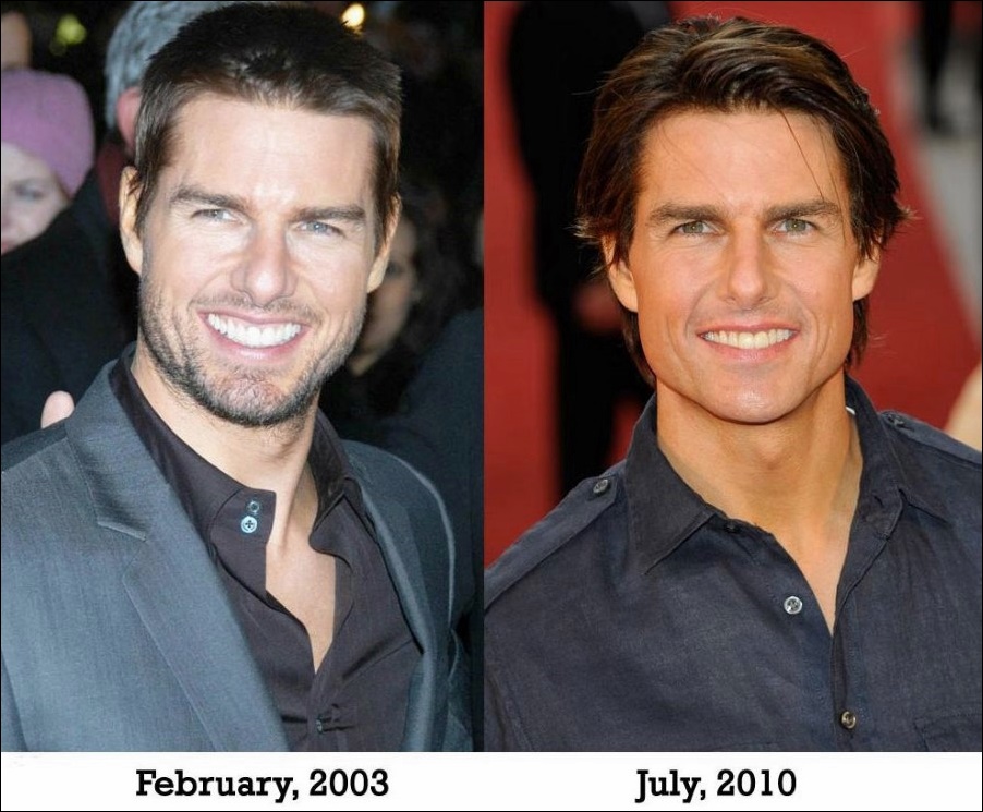 Tom Cruise wird mit Hilfe der plastischen Chirurgie immer jünger  