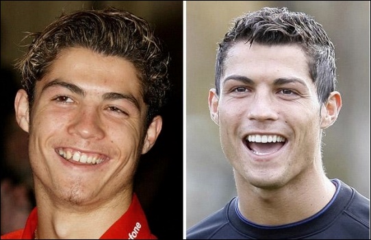 Cristiano Ronaldo Zähne plastische Chirurgie vor und nach Fotos  