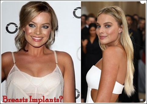 Margot Robbie Plastische Chirurgie vor und nach der Nase Job, Brüste Implantate Fotos  