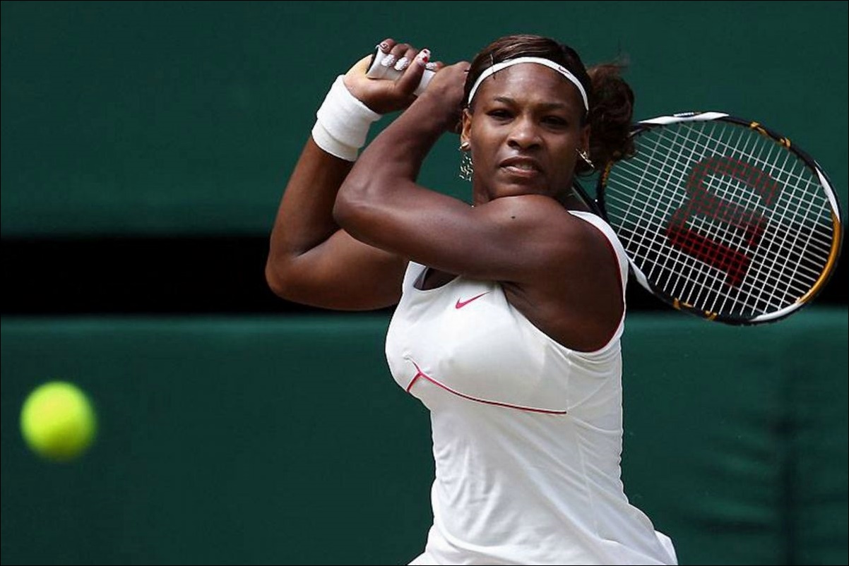 Serena Williams plastische Chirurgie vor und nach Bildern  