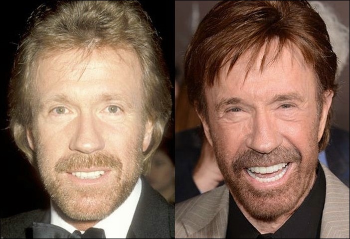Chuck Norris benutzt plastische Chirurgie?  