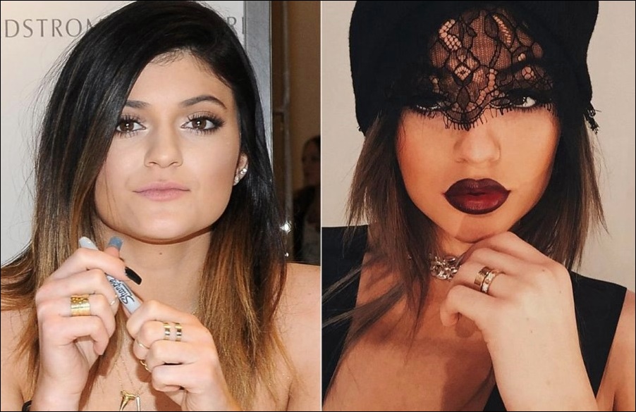 Kylie Jenner Plastische Chirurgie - ist sie zu jung?  