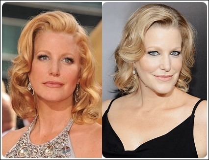 Anna Gunn Plastische Chirurgie vor und nach Botox, Facelift Fotos  