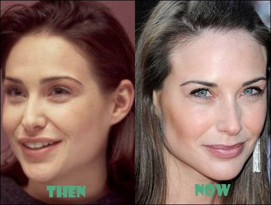 Claire Forlani Plastische Chirurgie vor und nach Botox Fotos  