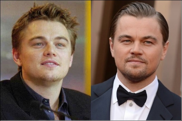 Leonardo DiCaprio Plastische Chirurgie vor und nach Nase Job Gerüchte  