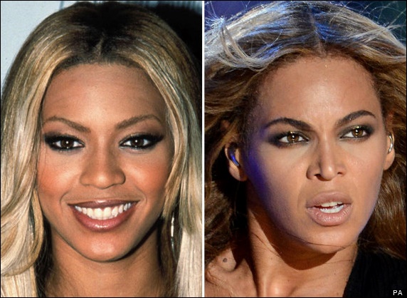 Beyonce Plastische Chirurgie vor und nach Nase Job Fotos  