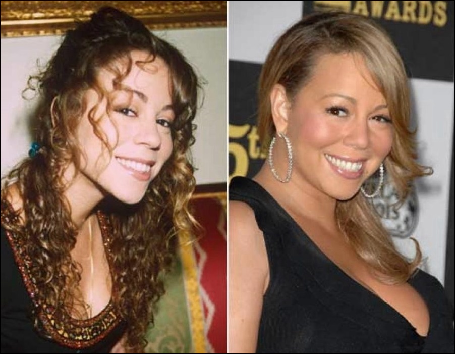 Mariah Carey vor und nach der plastischen Chirurgie  