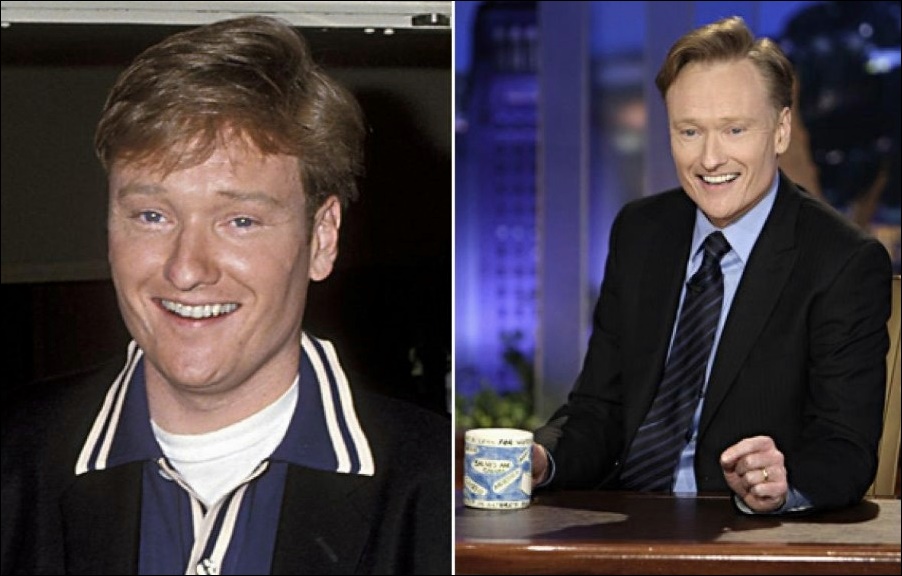 Conan O'Brien Plastische Operationen  