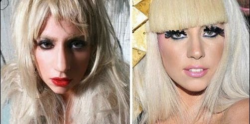 Lady Gaga Nase Job vor und nach  