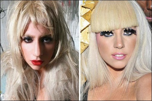 Lady Gaga Nase Job vor und nach  