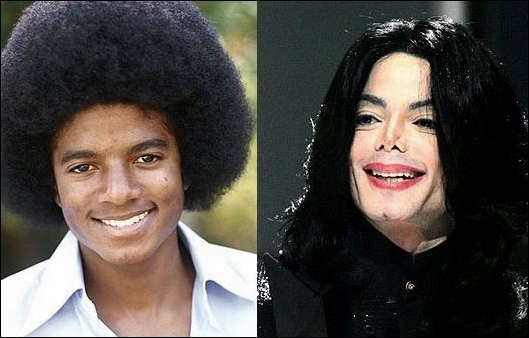 Michael Jackson Popstar unnötige plastische Chirurgie!  