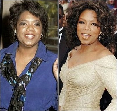 Oprah Winfrey Nase-Job-Chirurgie vor und nach Fotos  