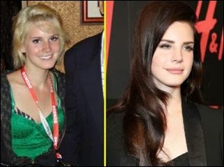 Lana Del Rey Plastische Chirurgie Gerüchte?  