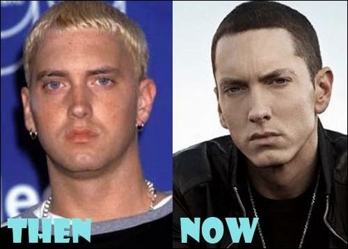 Eminems neuer Look und das Rätsel der plastischen Chirurgie  