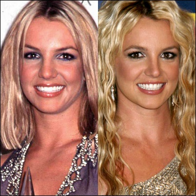 Britney Spears Plastische Chirurgie vor und nach Bildern  