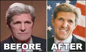 John Kerry plastische Chirurgie vor und nach Bildern  