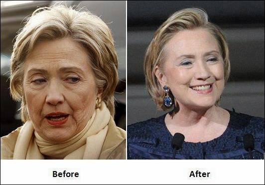 Hillary Clinton Facelift-Chirurgie vor und nach Fotos  