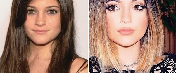 Kylie Jenner Plastische Chirurgie Vorher und Nachher  