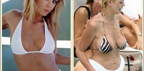 Tara Reid Plastische Chirurgie vor und nach den Bildern  