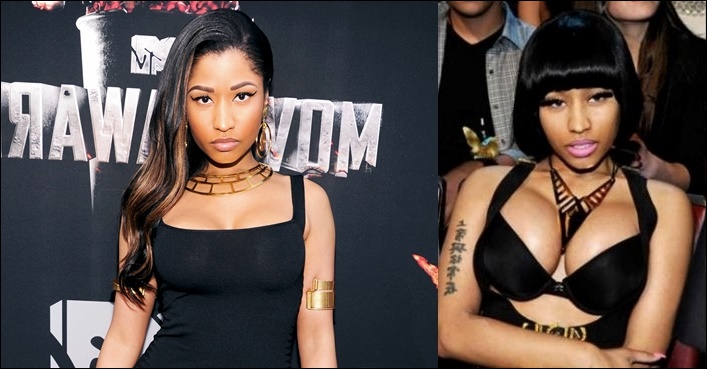 Nicki Minaj Plastische Chirurgie Vorher-Nachher Fotos  
