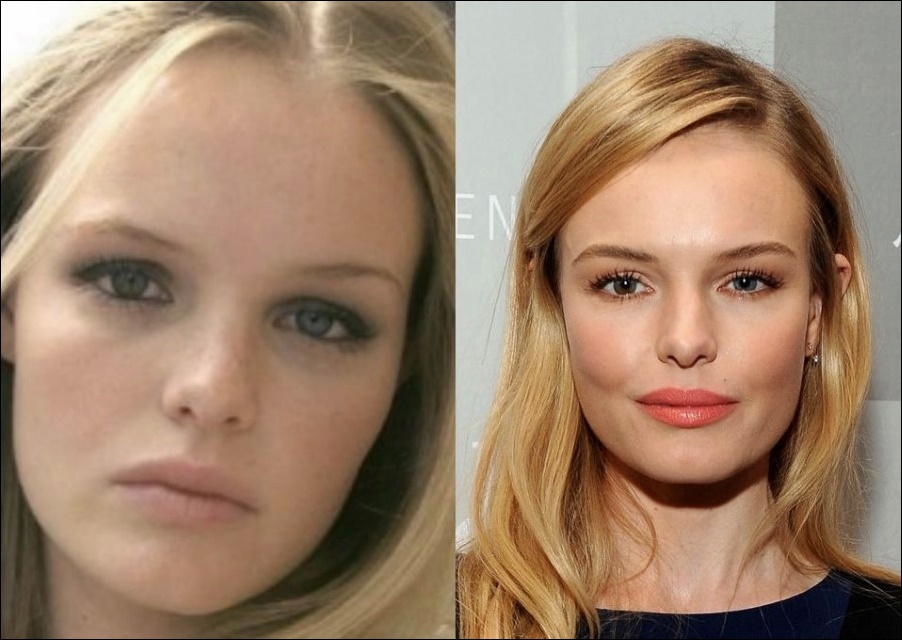 Kate Bosworth mehrere plastische Operationen  