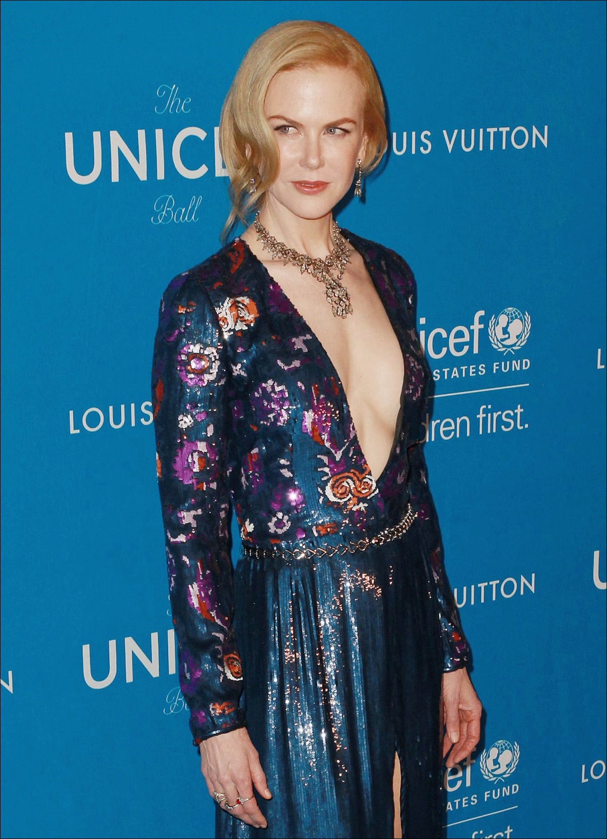 Nicole Kidman vor und nach der plastischen Chirurgie Bilder  