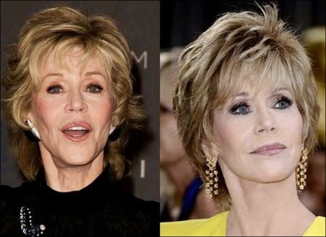 Jane Fonda Plastische Chirurgie Vorher-Nachher Bilder  
