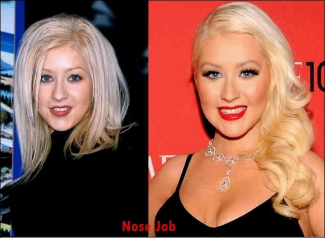 Christina Aguilera Nase Job Plastische Chirurgie Vorher-Nachher Bilder  