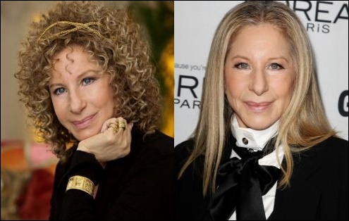 Barbra Streisands Reise zur Schönheit mit plastischer Chirurgie  
