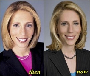 Dana Bash Plastische Chirurgie vor und nach Fotos  