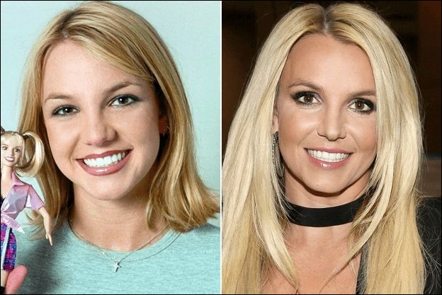 Britney Spears plastische Chirurgie ohne Folgen?  