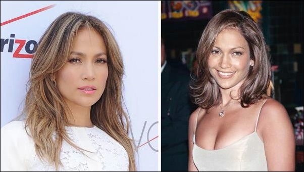 Jennifer Lopez Nase Job vor und nach den Bildern  