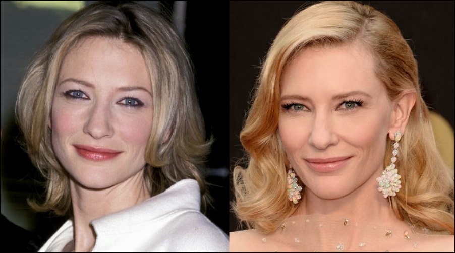 Cate Blanchett benutzt plastische Chirurgie?  