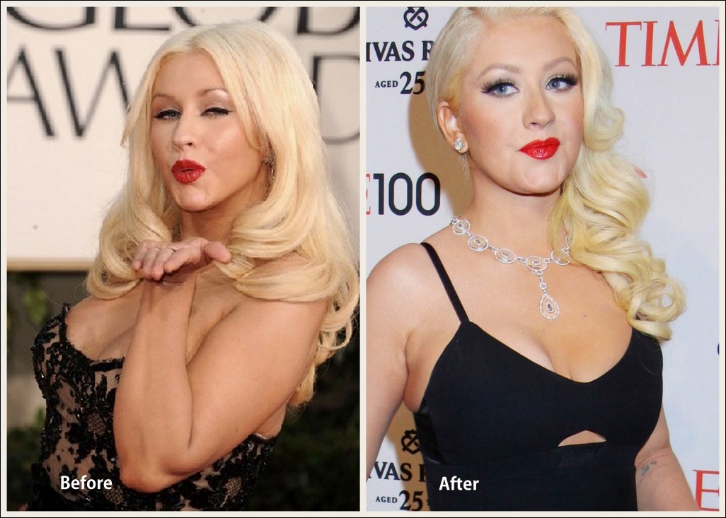 Christina Aguilera Nase Job Plastische Chirurgie Vorher-Nachher Bilder  