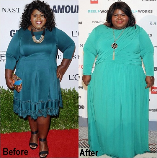 Gabourey Sidibe Gewichtsverlust Chirurgie vor und nach Fotos  