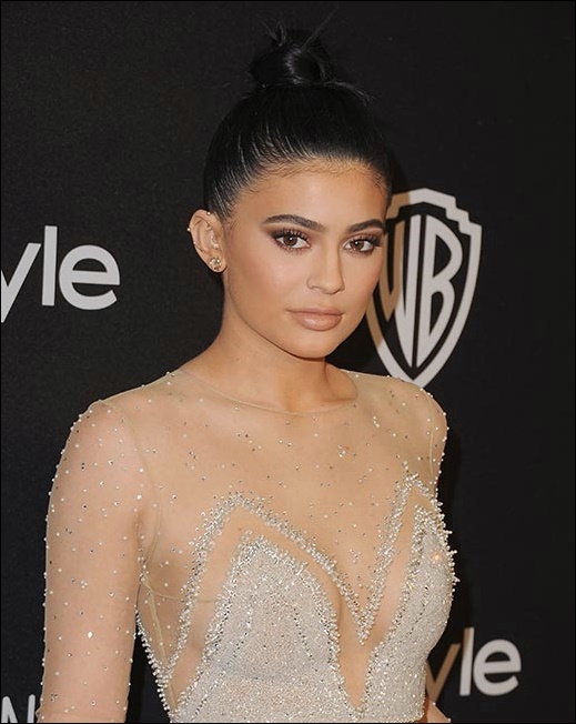 Kylie Jenner Plastische Chirurgie Vorher und Nachher  