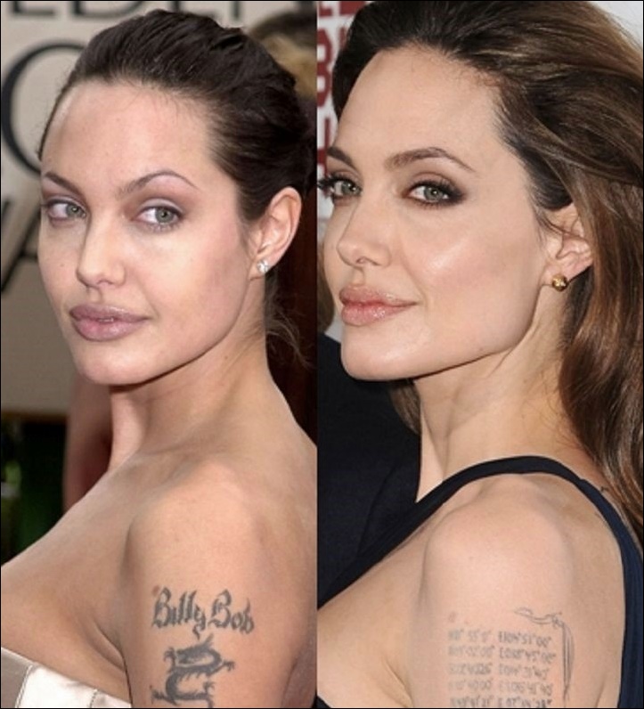 Angelina Jolie plastische Chirurgie zwickt, um ihre Schönheit zu verbessern!  