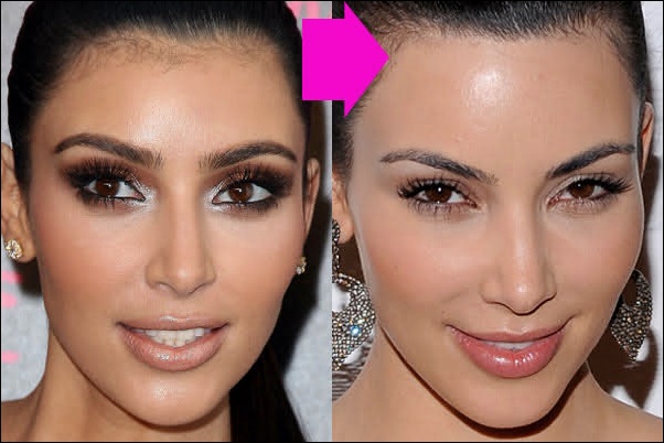 Kim Kardashian Laser-Haarentfernung Vorher-Nachher Bilder  