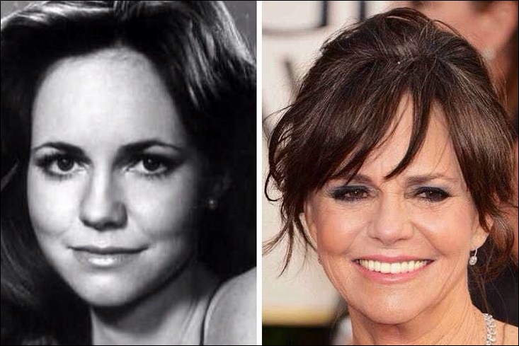 Sally Field Hat sie plastische Chirurgie erlebt?  