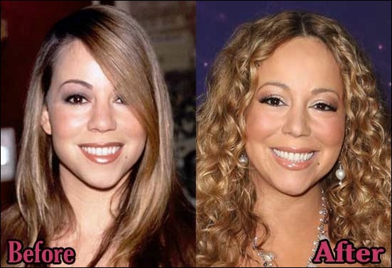 Mariah Carey Nase Job Plastische Chirurgie vor und nach dem Bild  