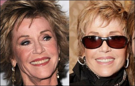 Jane Fonda Plastische Chirurgie ging gut  