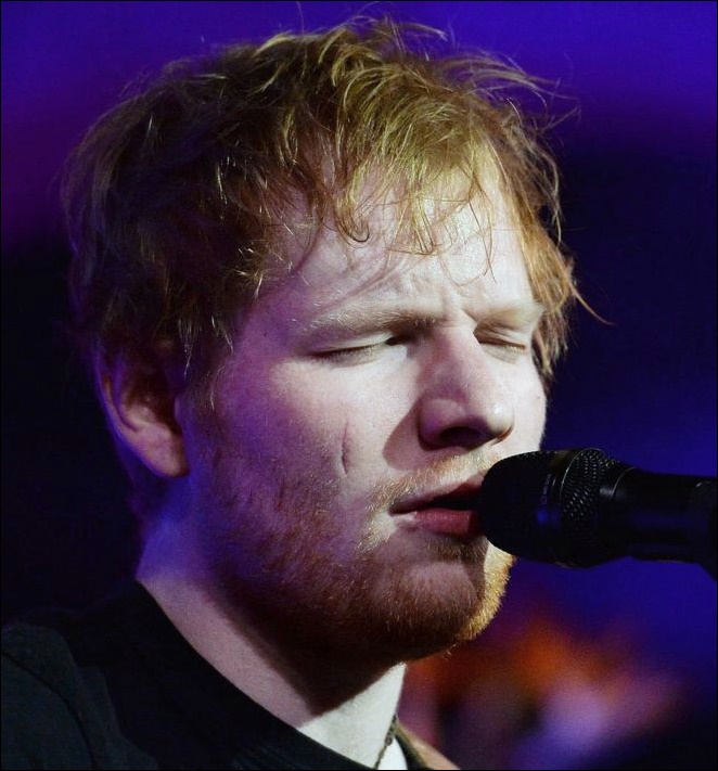 Ed Sheeran Plastische Chirurgie vor und nach Gesicht Fotos  